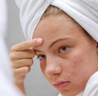 Коррекция акне и постакне: шея