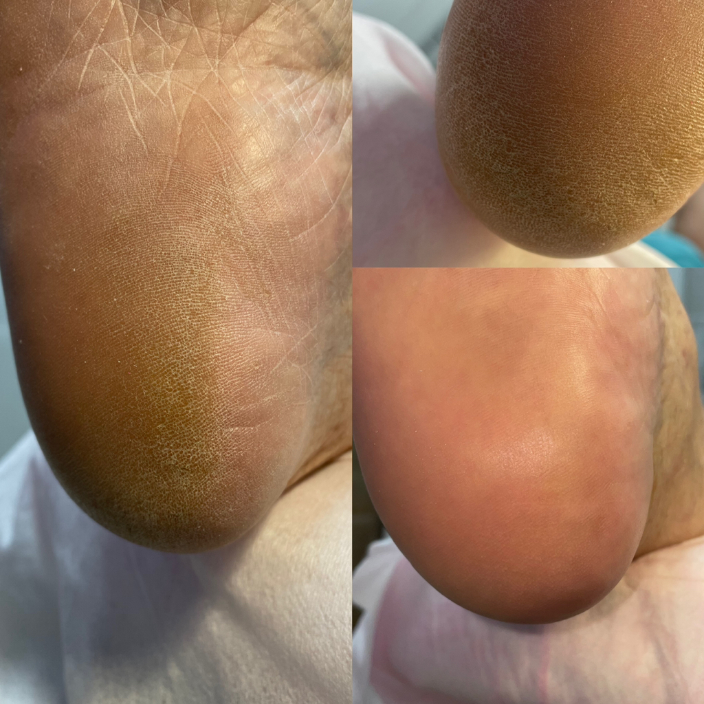 SMART педикюр + покрытие