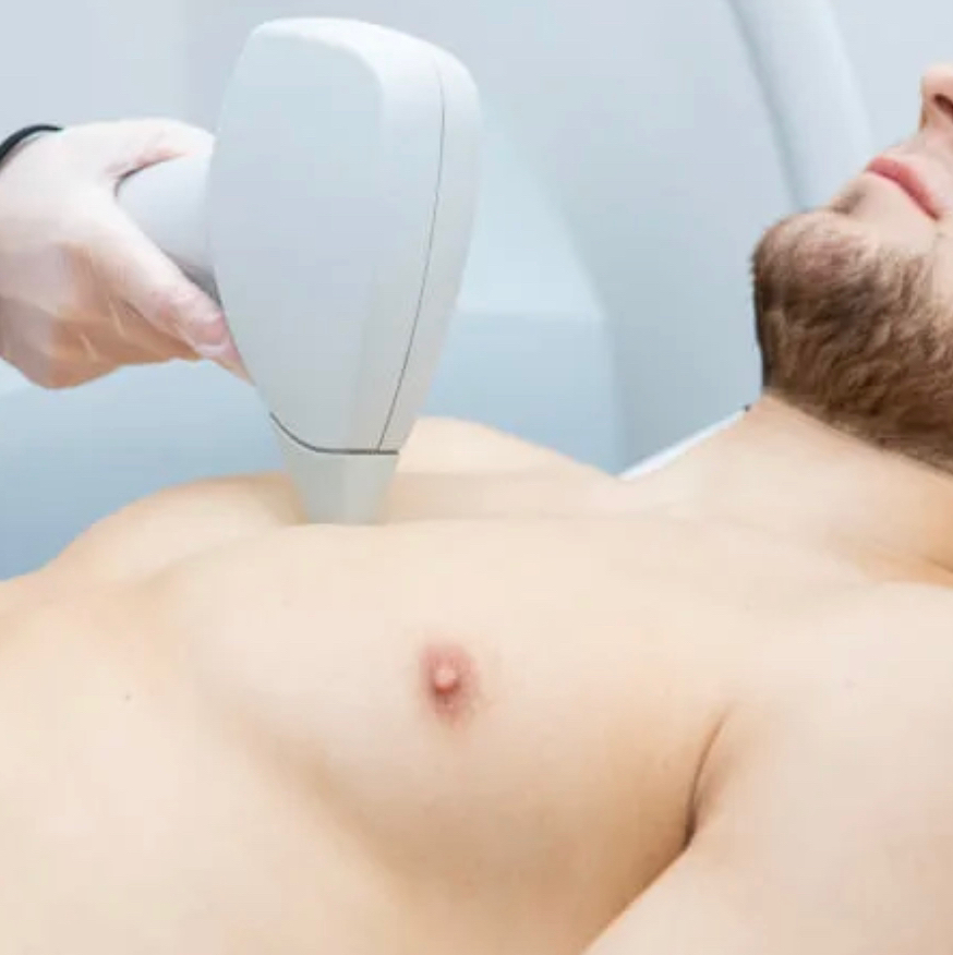 IPLASER эпиляция:  Грудь полностью