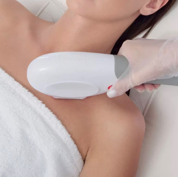 IPLASER эпиляция:  Декольте