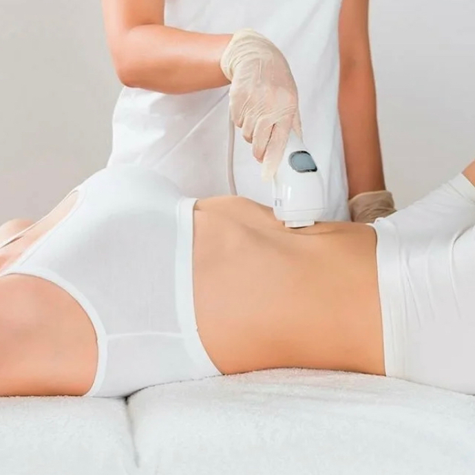 IPLASER эпиляция: Живот полностью