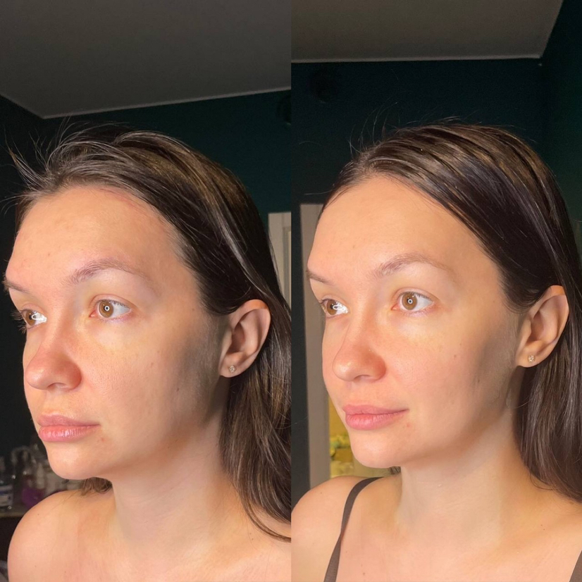 Лифтинг-массаж лица, 30+ (Включает массаж ШВЗ)