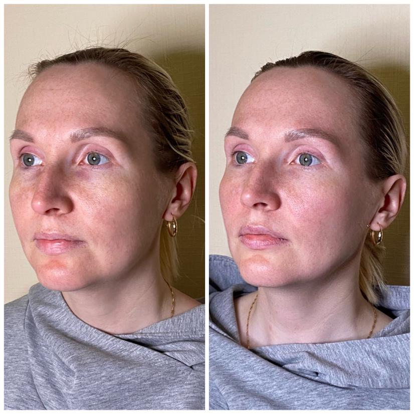 Релакс-массаж лица по крему (любой возраст, включает массаж ШВЗ)