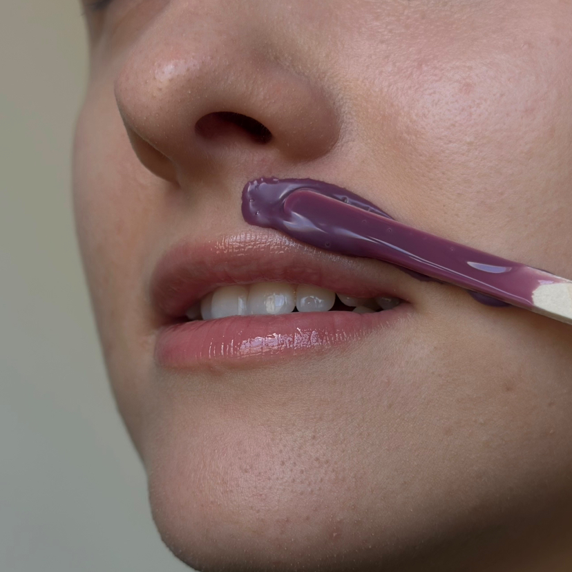 Удаление лишних волосков на лице