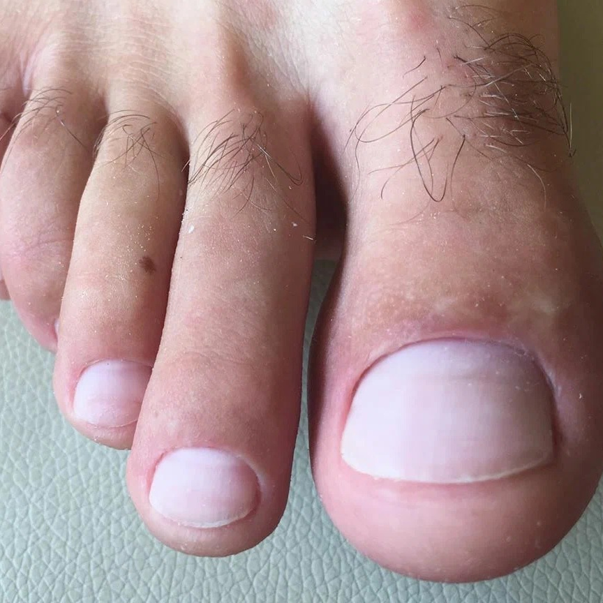 Мужской педикюр