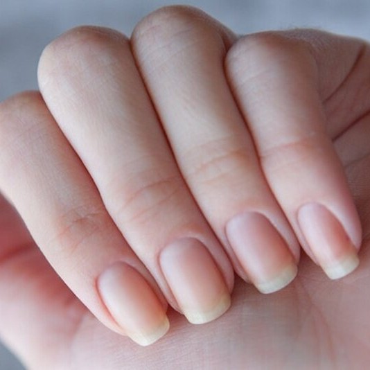 Коррекция ногтей