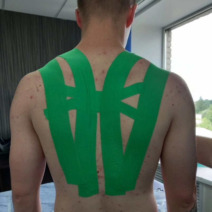 Нарушение осанки, коррекция сутулости у детей и взрослых