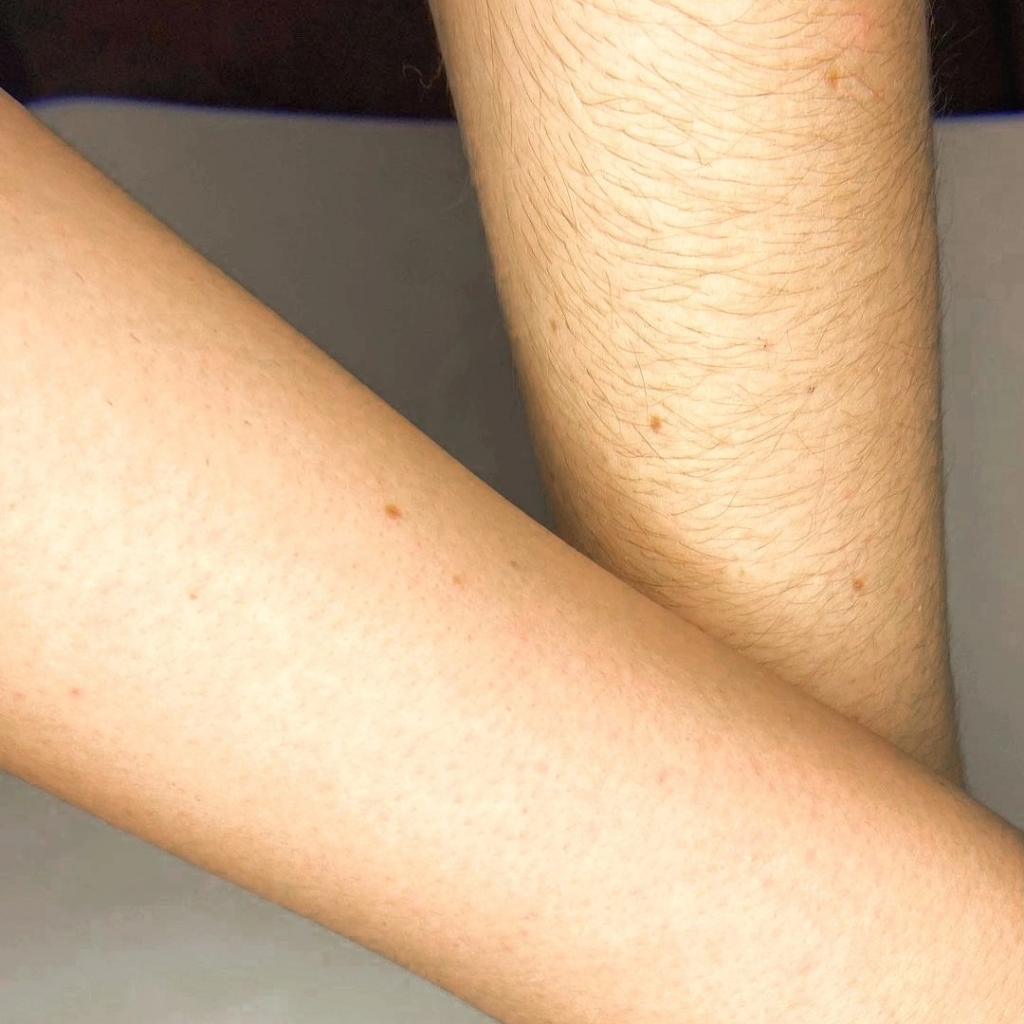 Руки  до локтя