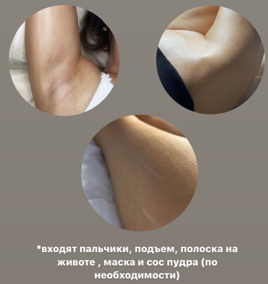 Комплекс 3 (бикини, ноги полностью, подмышки) Зона животика в подарок