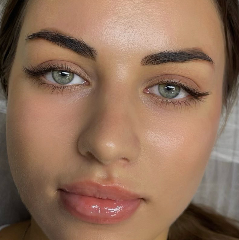 Наращивание уголков