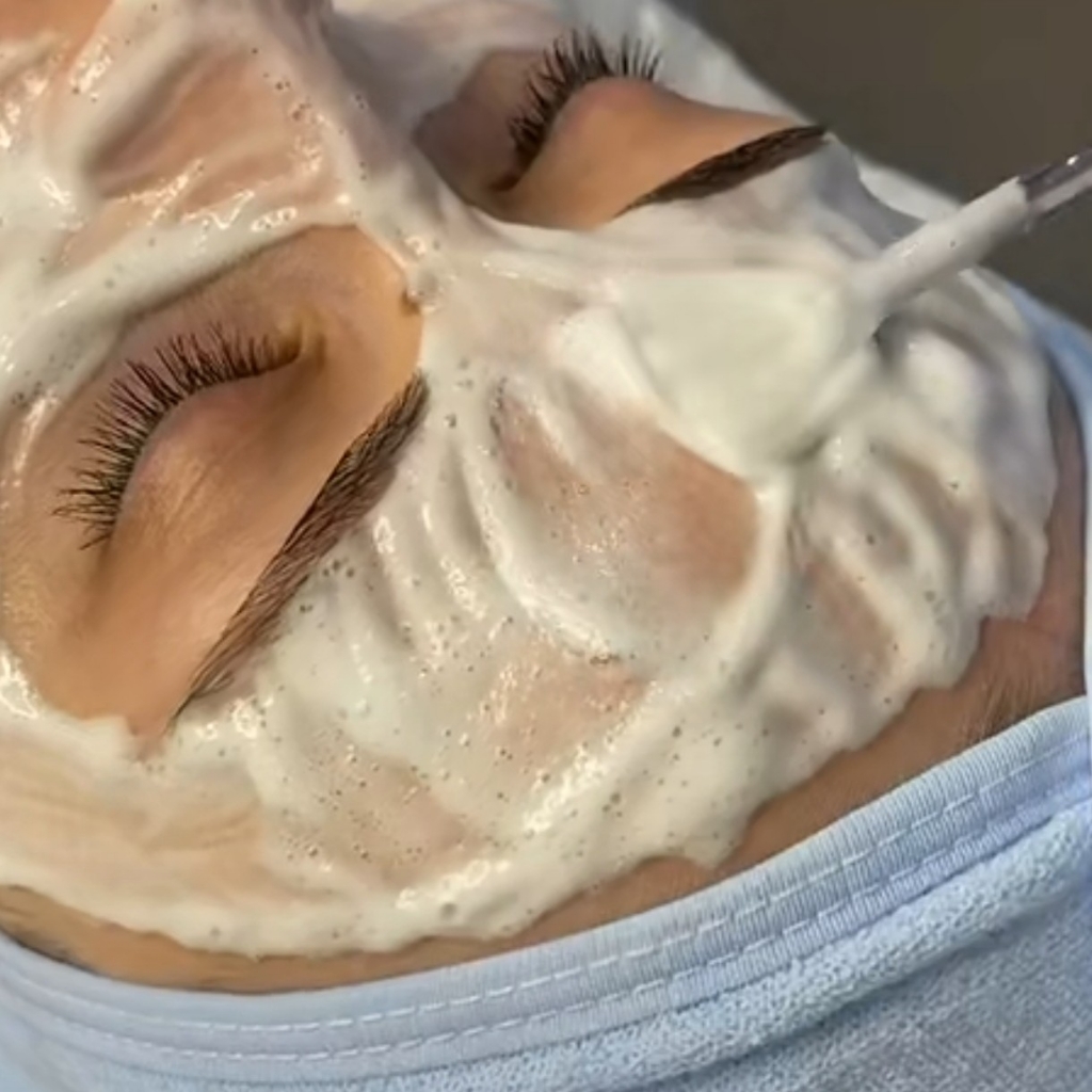 Карбокситерапия безинъекционная