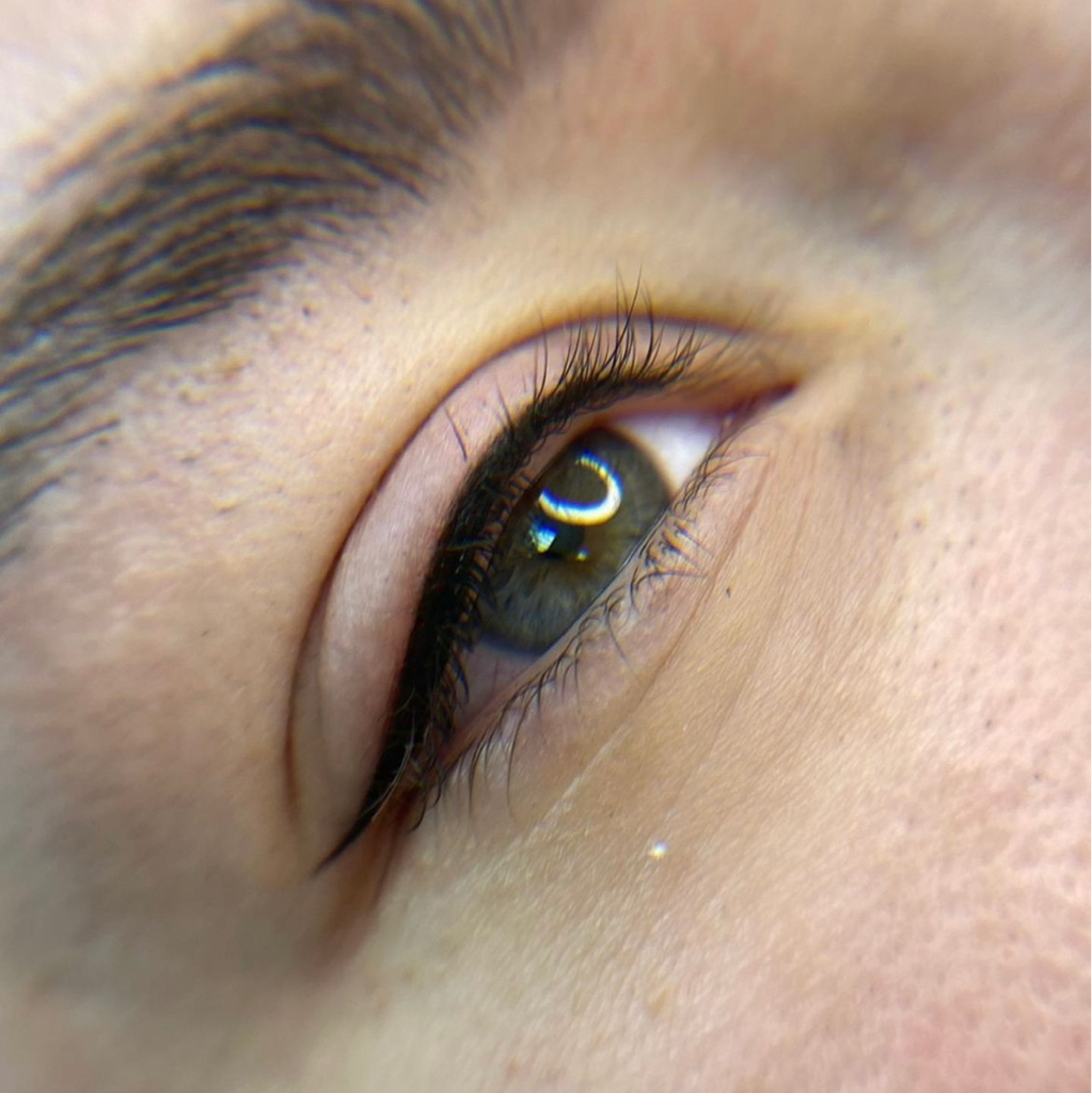 Первичная процедура, ПМ межресничная зона, со стрелкой