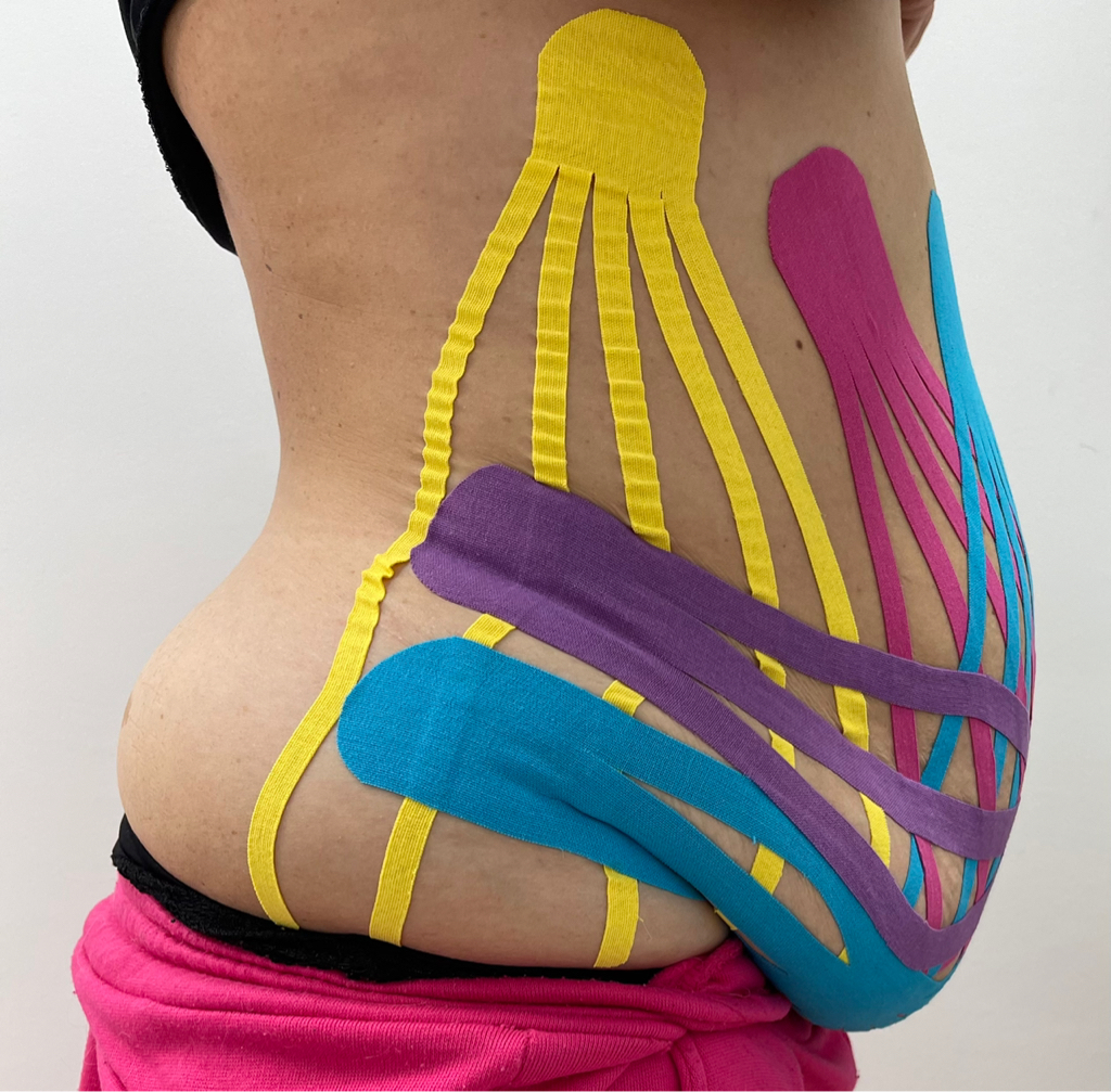 Тейпирование «БОЛЬШОЙ ЖИВОТ» - 1 процедура