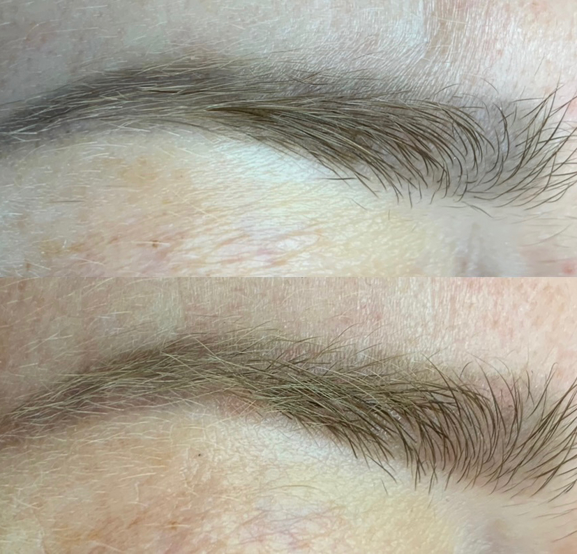 Удаление ремувером