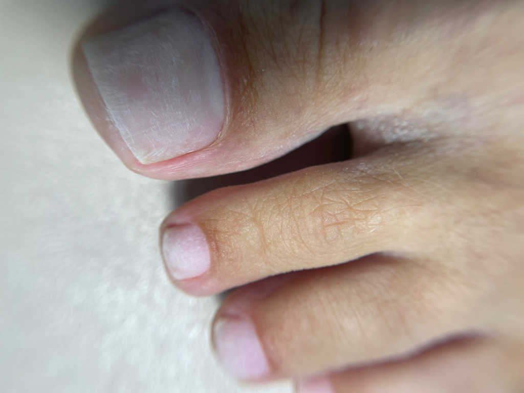 Педикюр без покрытия полная обработка пальчиков и стоп