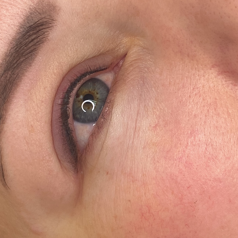 ВЕКИ - « пушистая межресничка»