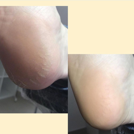 Обработка трещин