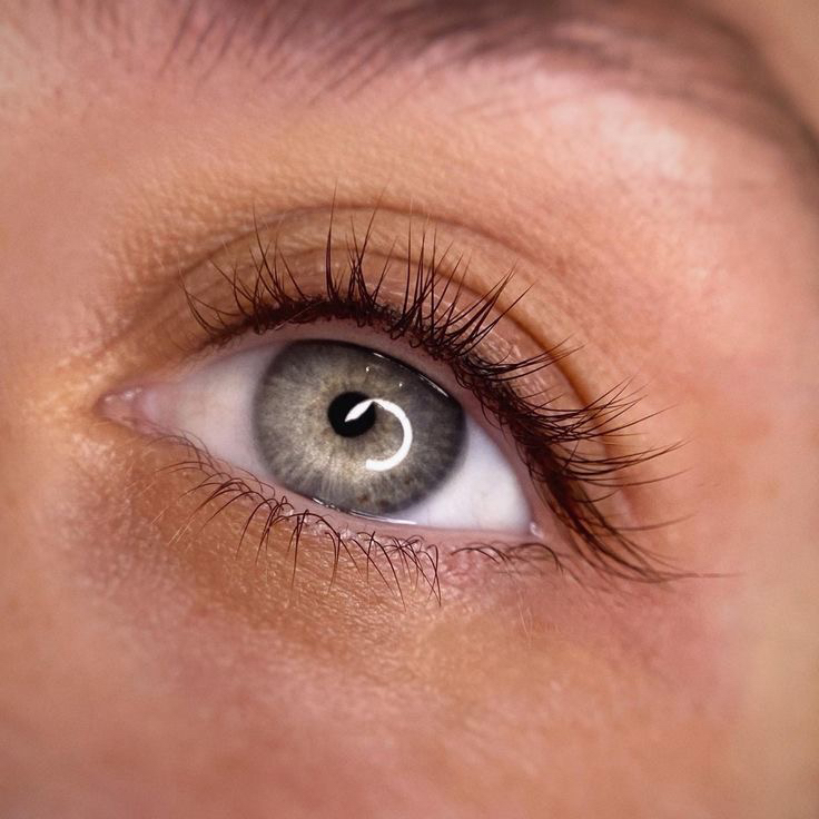 Коррекция МЕЖРЕСНИЧКИ