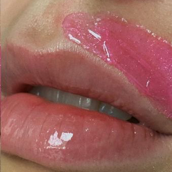 Депиляция верхней губы