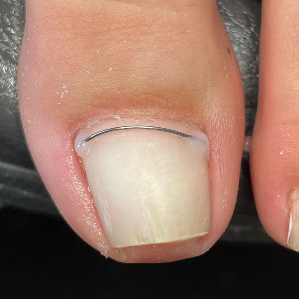 Установка корректирующей системы