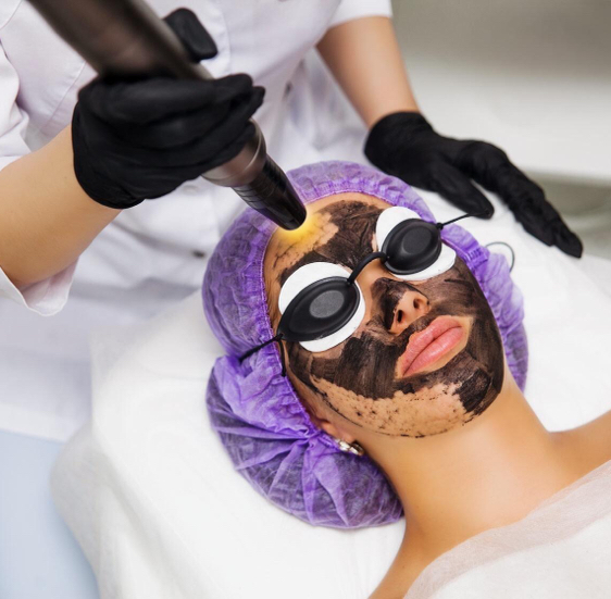 Карбоновый пилинг