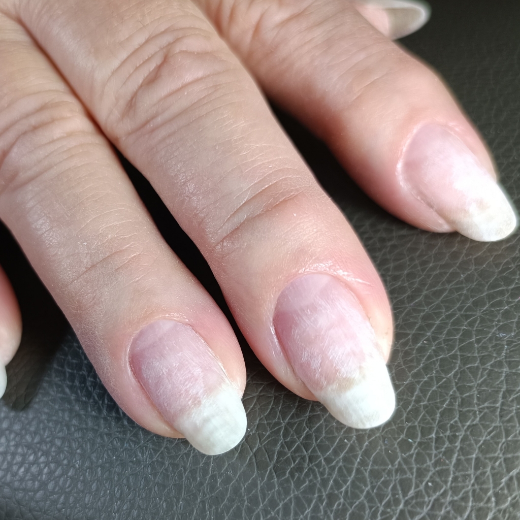 СНЯТИЕ+МАНИКЮР