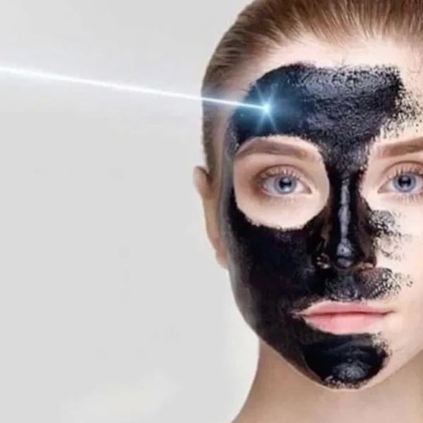 КАРБОНОВЫЙ ПИЛИНГ