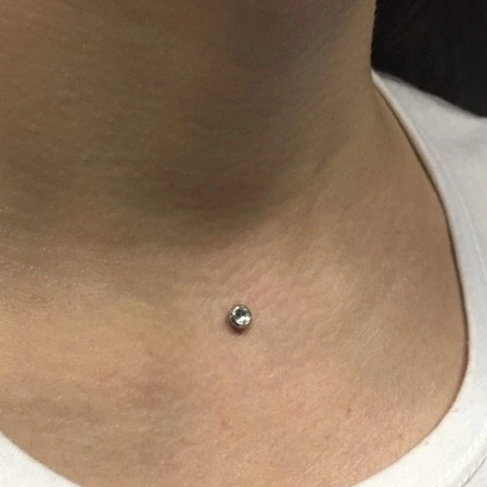 Чистка/удаление микродермала