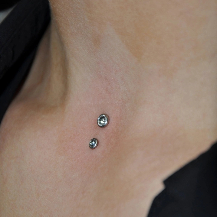 Микродермал