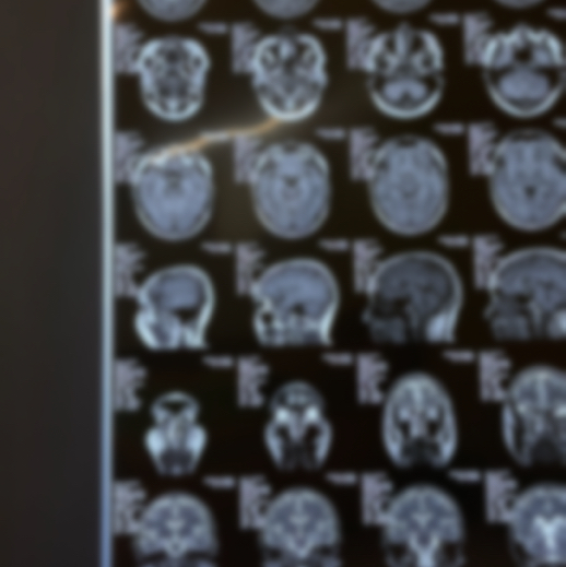 Онлайн консультация невролога (прочитайте пожалуйста условия)