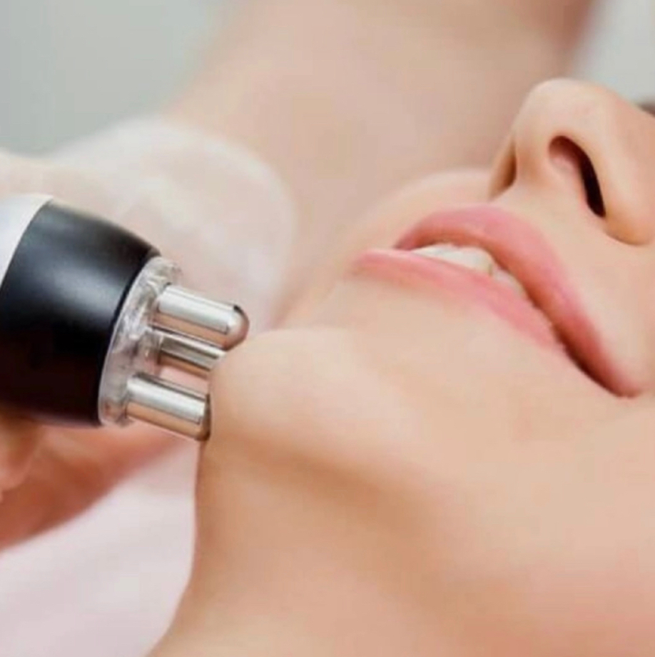 RF лифтинг 1/3 лица