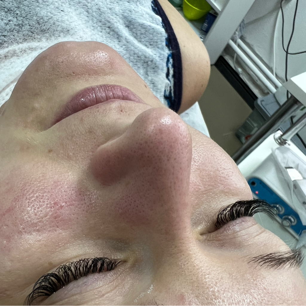 Комбинированная очищение  лица