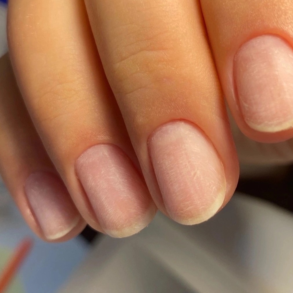 снятие нарощеных