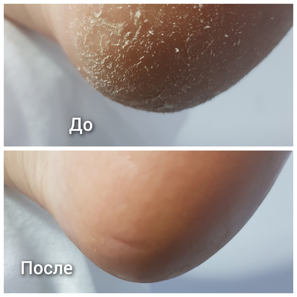 Педикюр - комплекс без покрытия