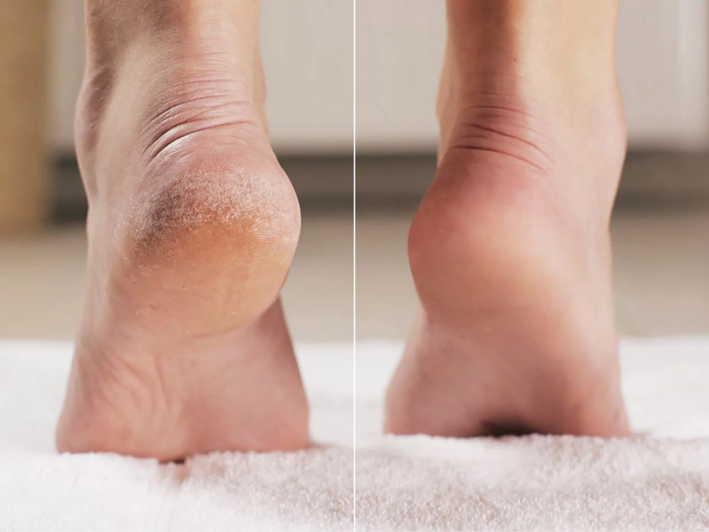 Педикюр без покрытия с обработкой стоп