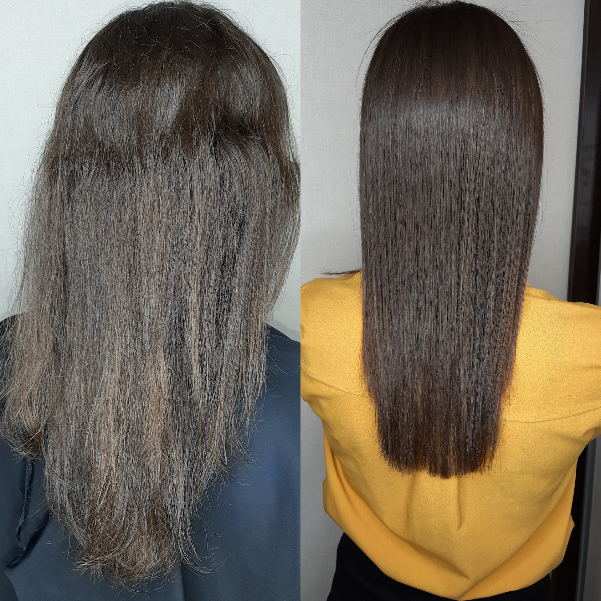 Биксипластия (длинные волосы)