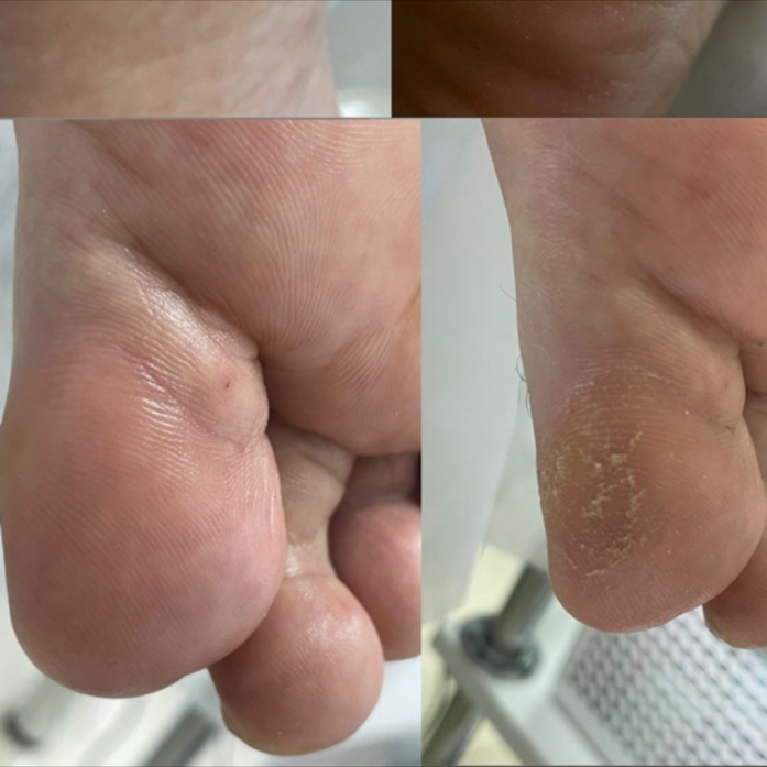 Педикюр «обработка стоп и пальчиков»