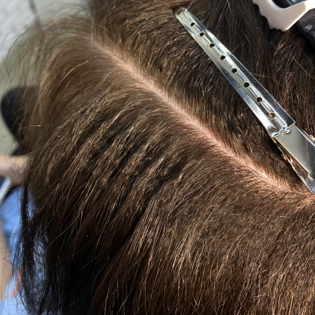 Коррекция волос примерно 400 капсул.