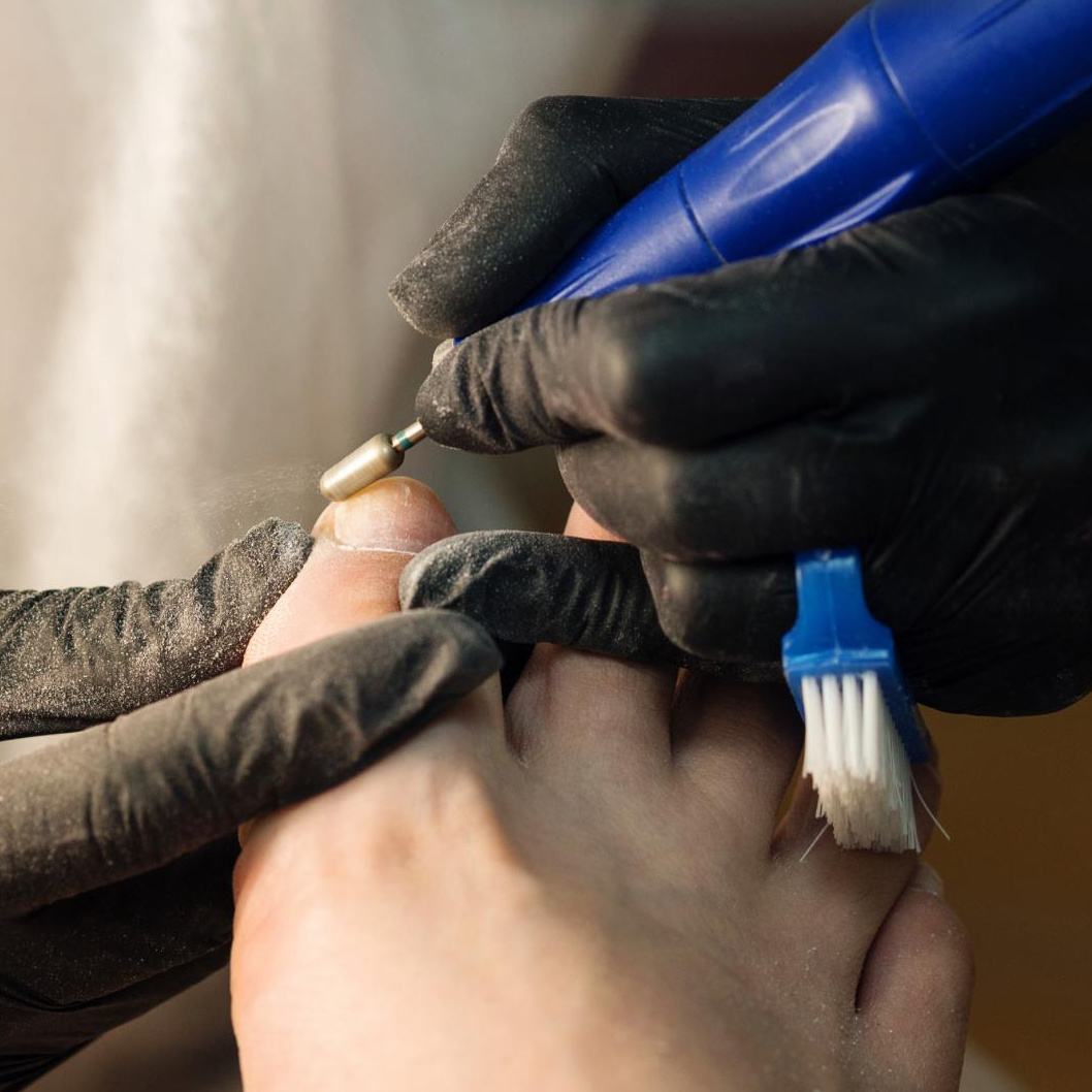 Снятие старого покрытия на ногах (без последующей работы)