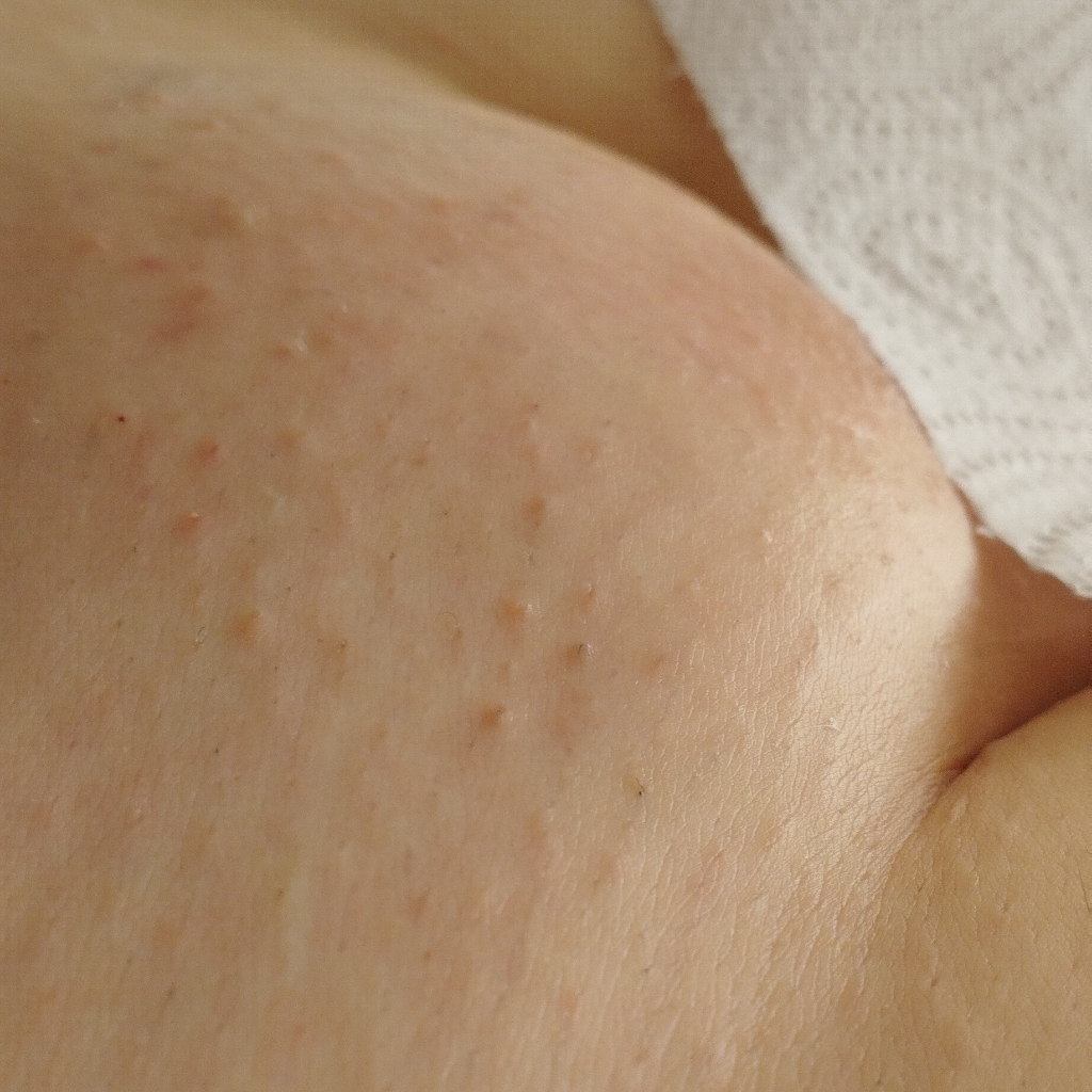 Бикини Глубокое Первичное