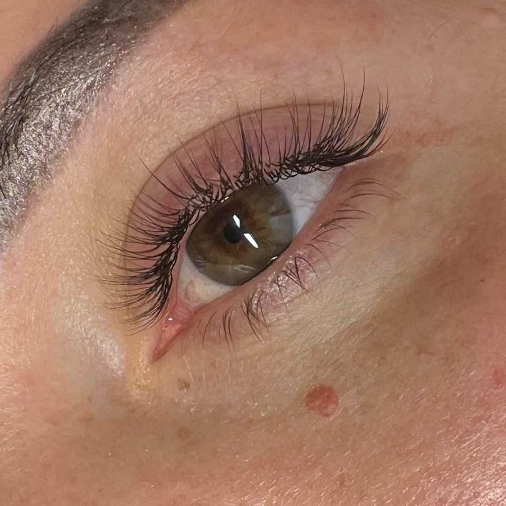 Классическое наращивание (1D)