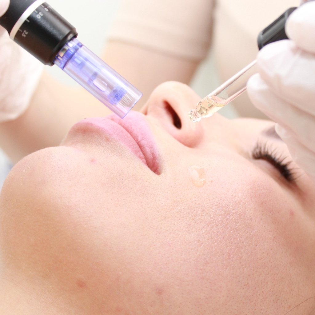 "Идеальная кожа"