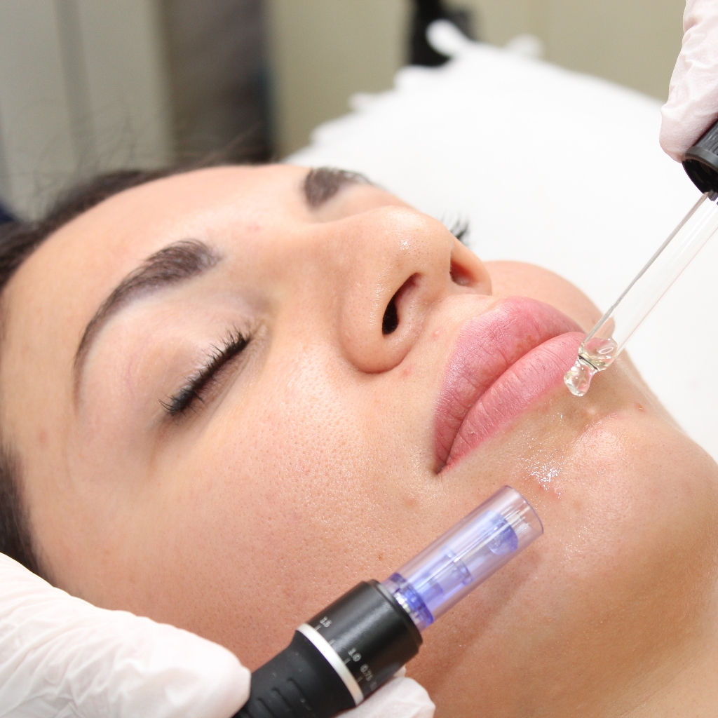 "Стоп Пигмент"