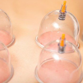 Хиджама оздоровительная