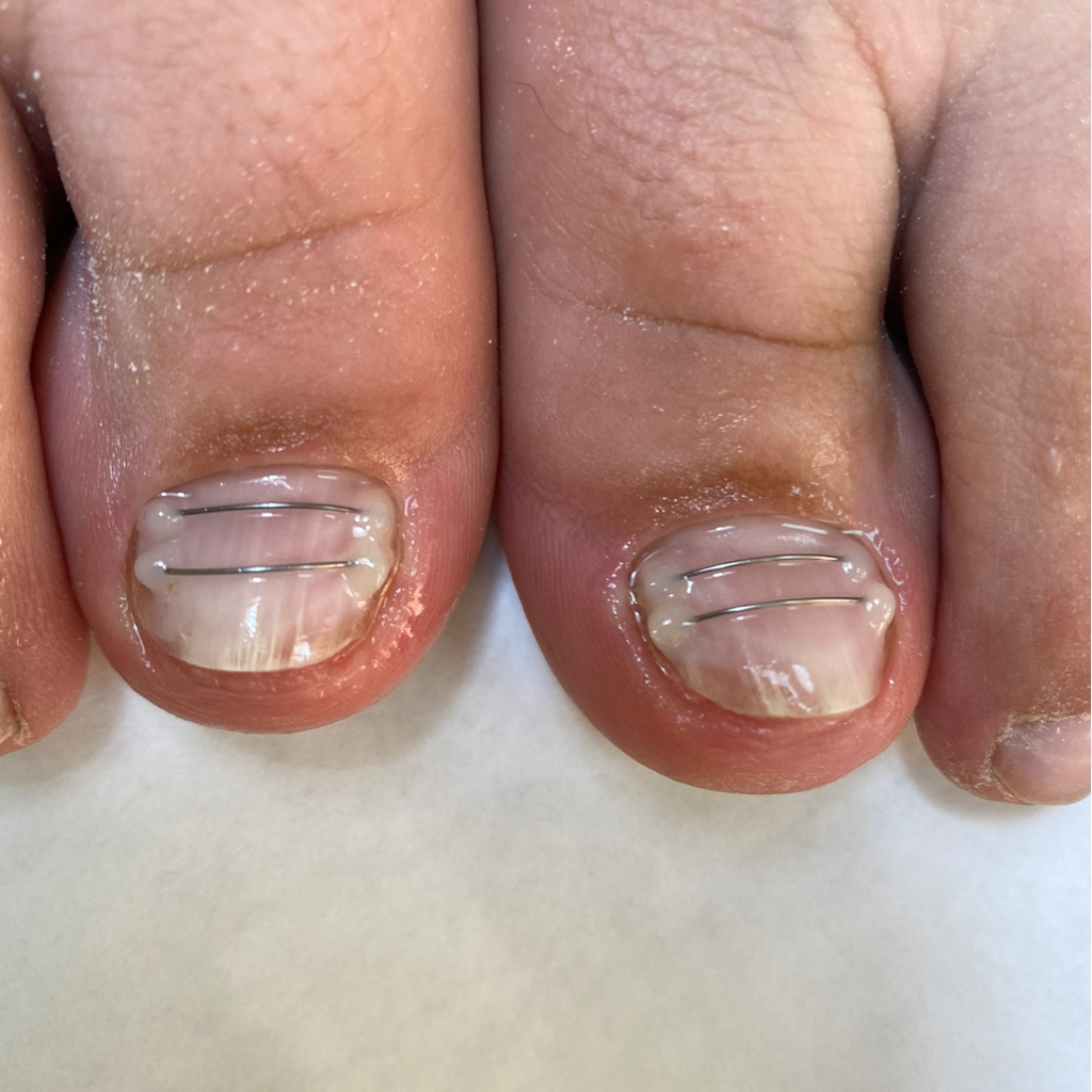 Титановая нить