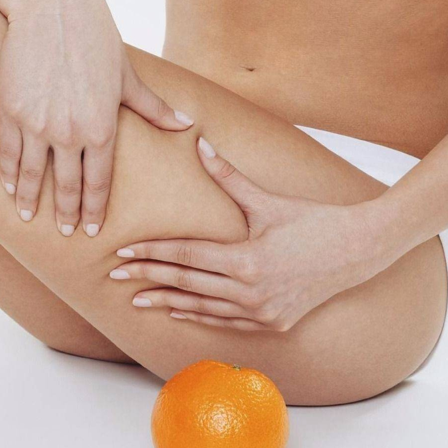 Антицеллюлитный массаж