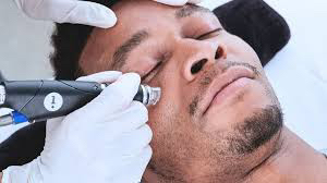 Activate combo facial HydraFacial + deep peeling