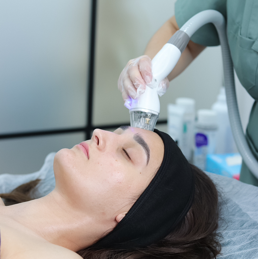 RF-лифтинг лица