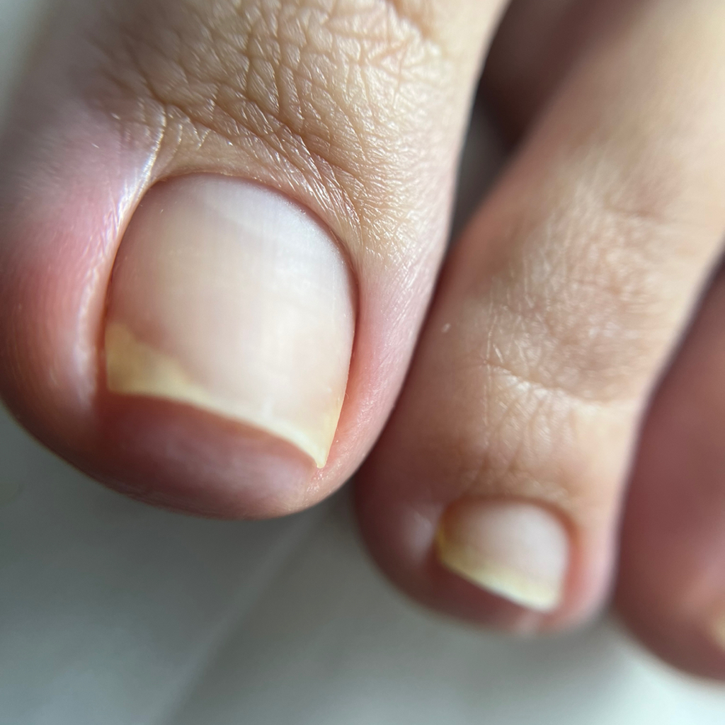 Педикюр (только пальчики)