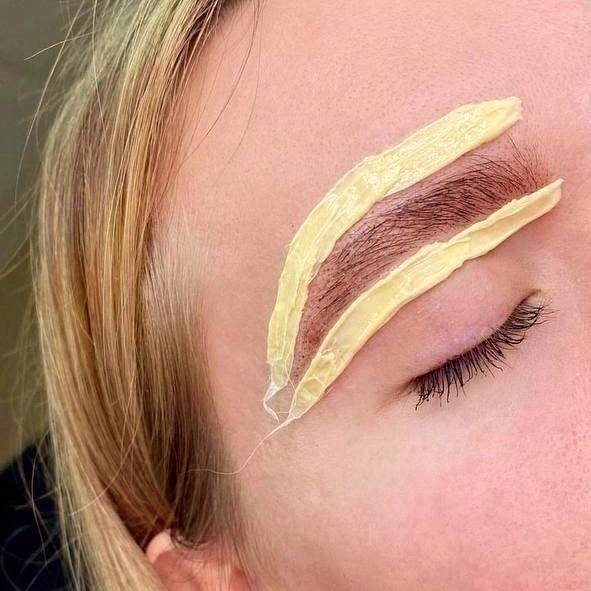 Депиляция любой зоны на лице